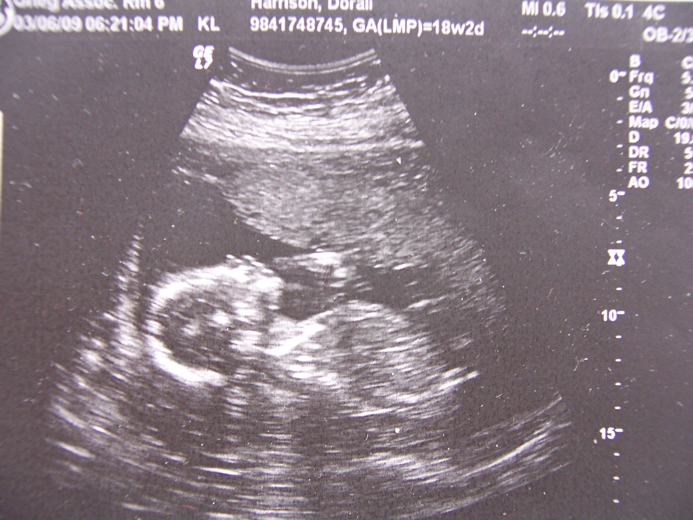 Baby's hand by face, laying on it's back.